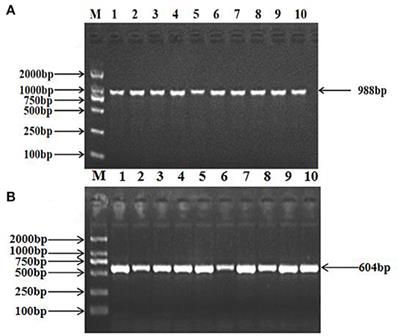 Identification of TRAPPC9 and BAIAP2 Gene Polymorphisms and Their Association With Fat Deposition-Related Traits in Hu Sheep